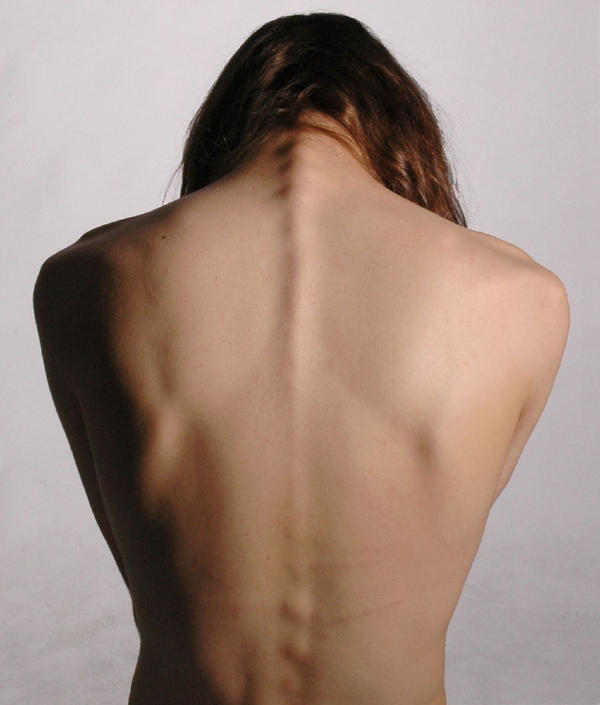 spine back