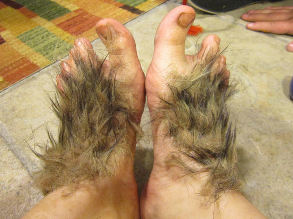 Hairy Feet Pictures 50